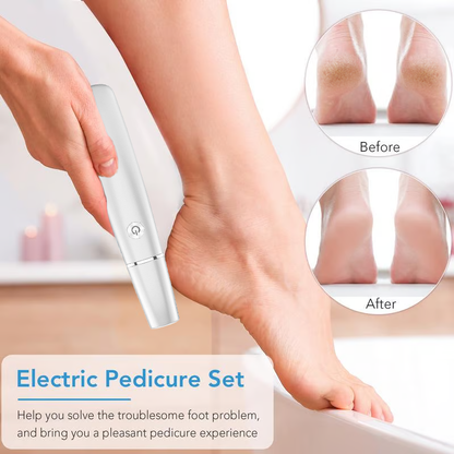 🔥Hot Sale 50% OFF!!⚡50K+ SOLD!❤️Electric Feet Callus Remover⚡