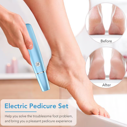 🔥Hot Sale 50% OFF!!⚡50K+ SOLD!❤️Electric Feet Callus Remover⚡