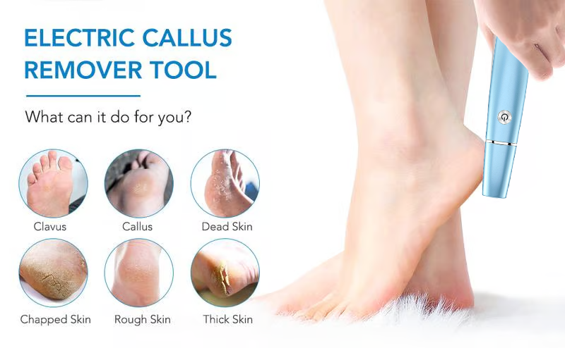 🔥Hot Sale 50% OFF!!⚡50K+ SOLD!❤️Electric Feet Callus Remover⚡