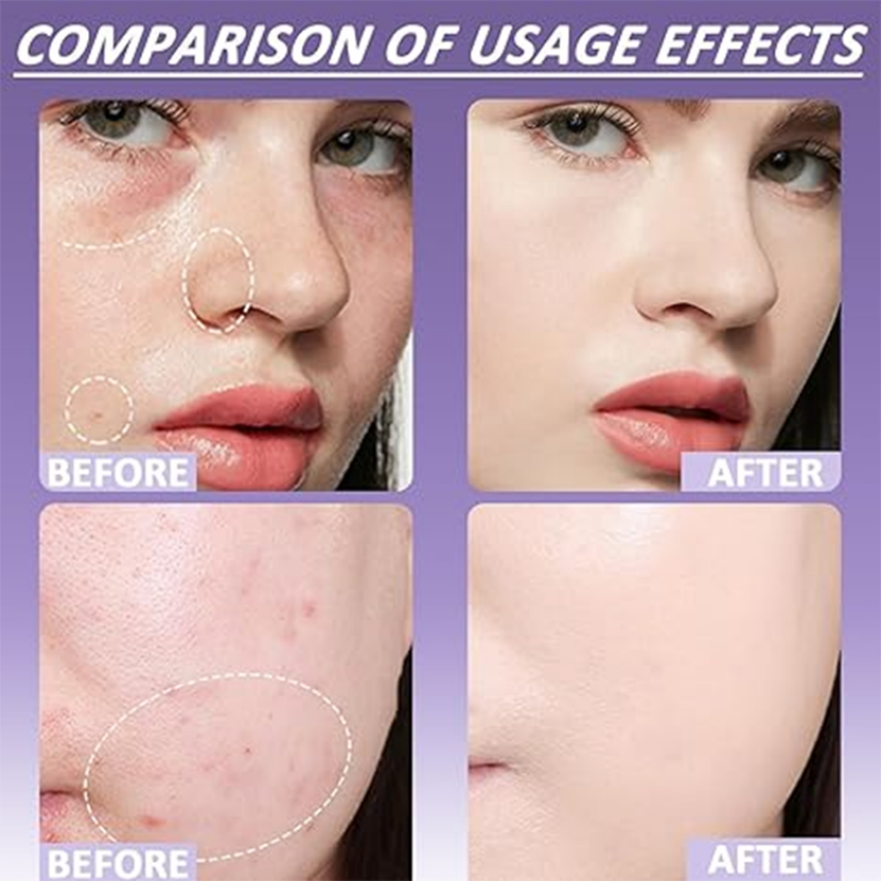 Matte Concealer for Face & Body