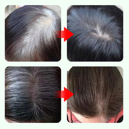 ✏️ BUY 2 GET 1 FREE! ✨ Temporary Gray Coverage Hair Dye Pen - 10-Second Root Touch-Up with Water-Resistant Formula for Instant Youthful Look 🌟🧴