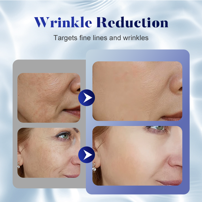 🎄Christmas Sale🔥Little Red Cap Anti-Aging Face Cream